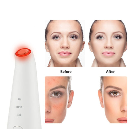 Photon Facial Rejuvenation Massager - thebodyrelief.com 